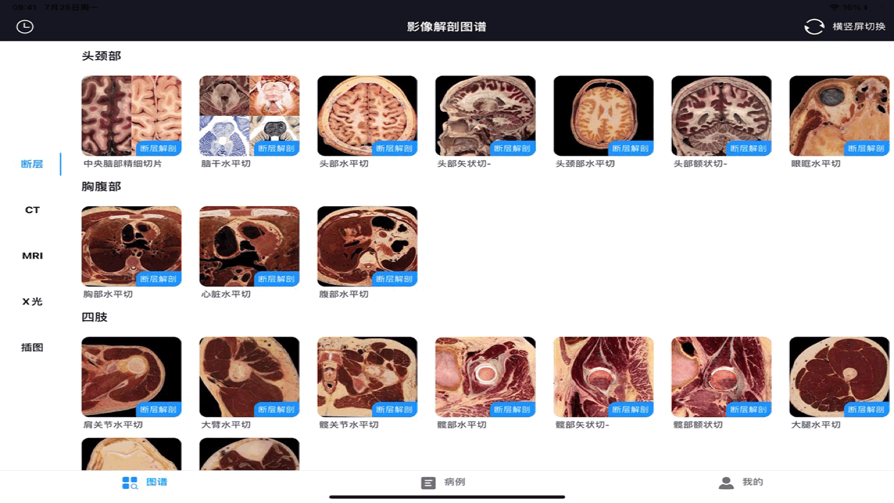 医学生必备软件：影像解剖图谱永久会员限时抢购