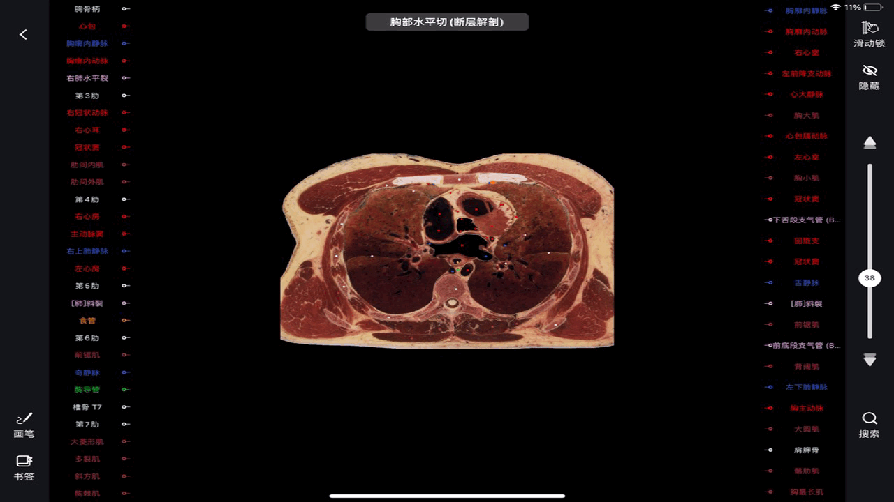 医学生必备软件：影像解剖图谱永久会员限时抢购